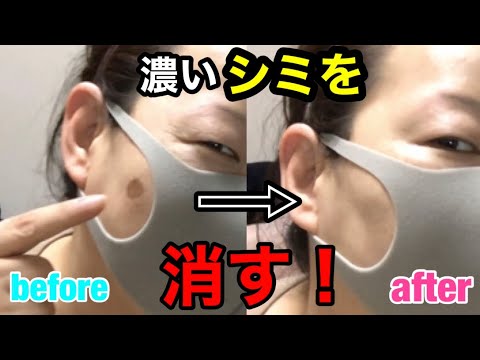 濃いシミを隠す必殺技を教えちゃいます お悩み解決 Youtube