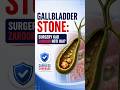 Gallbladder Stone Insurance Cover! 💸 क्या गॉल ब्लैडर सर्जरी का पूरा खर्चा इंश्योरेंस देता है