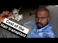 Cost of the hair transplant in turkeytamil 2800