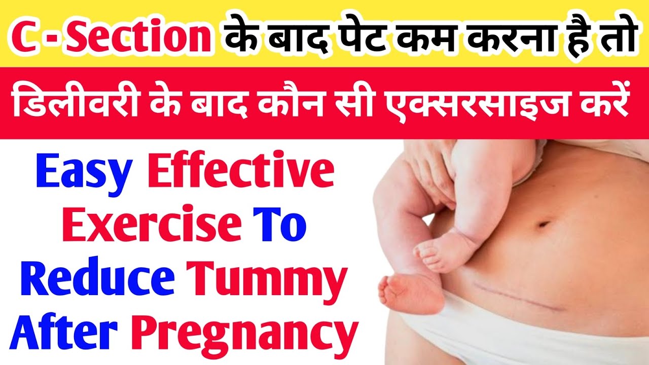 Exercise To Reduce Tummy After Delivery | After Delivery Exercise For Women | pet ki exercise |