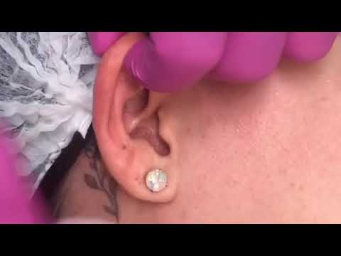 Inner Helix Piercing - YouTube