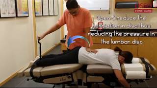 Flexion Distraction Adjustment Technique - Chiropractic Technique