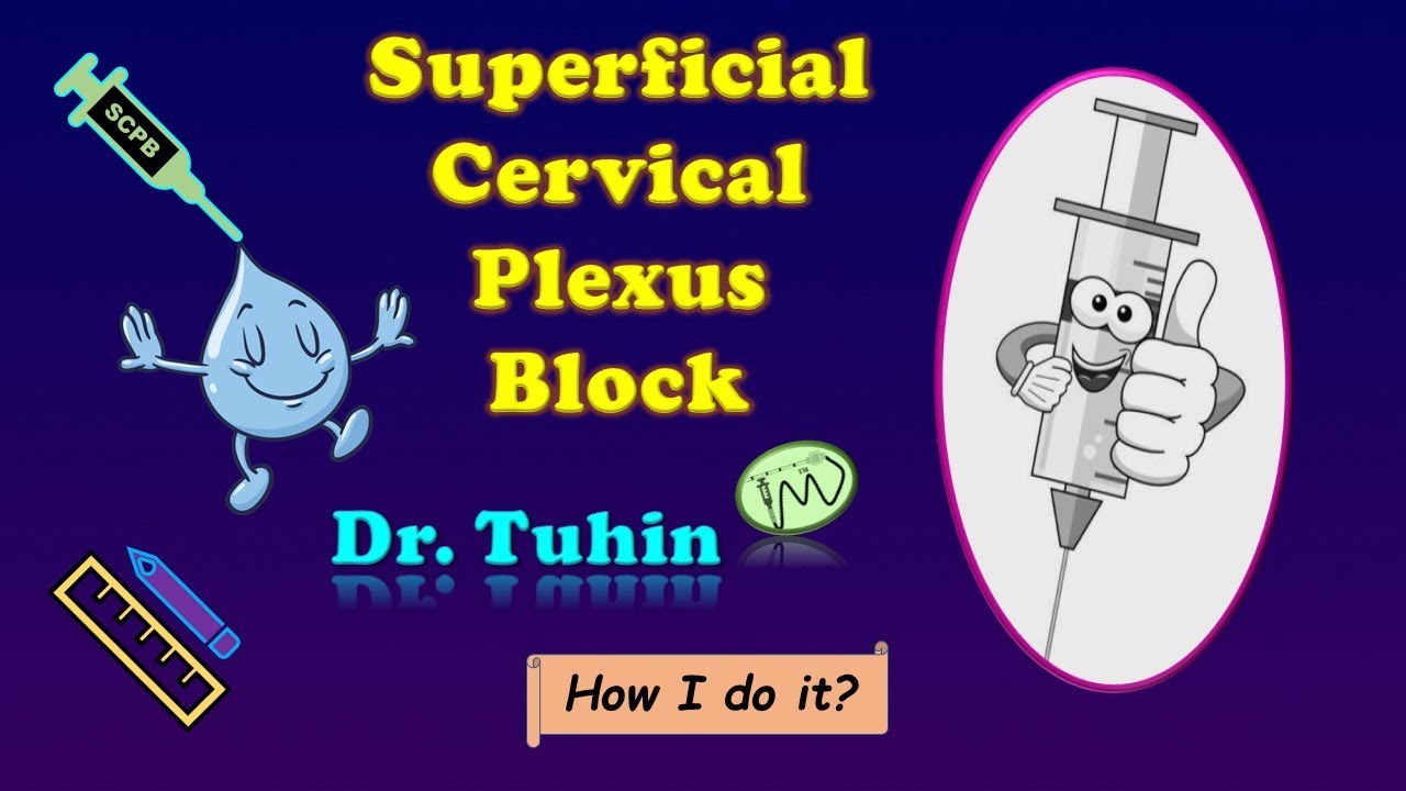 Superficial Cervical Plexus Block Landmarkguided technique