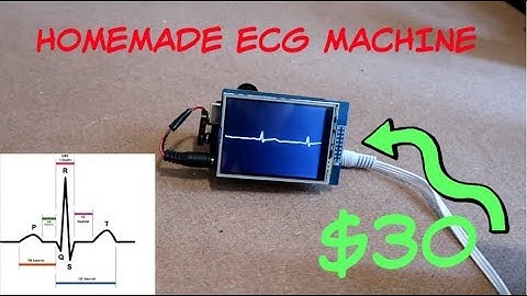 Homemade ECG Machine