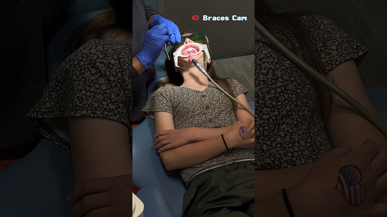 LIV GETTING BRACES FOR THE FIRST TIME 😬