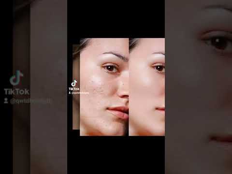 وااخيراا رجع توفر الاصلي كريم كيتو احذرو التلقيد محارب الكلف لاستفسار واتساب 07819249072