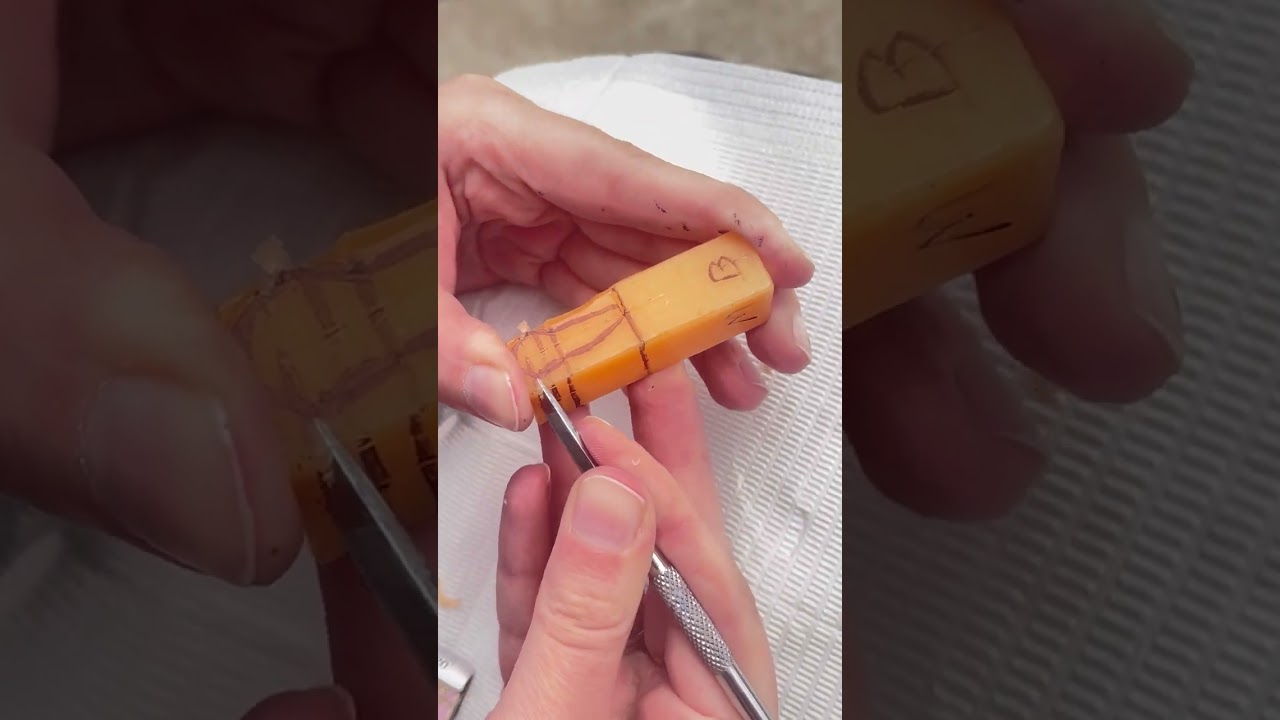 Maxillary first premolar 1