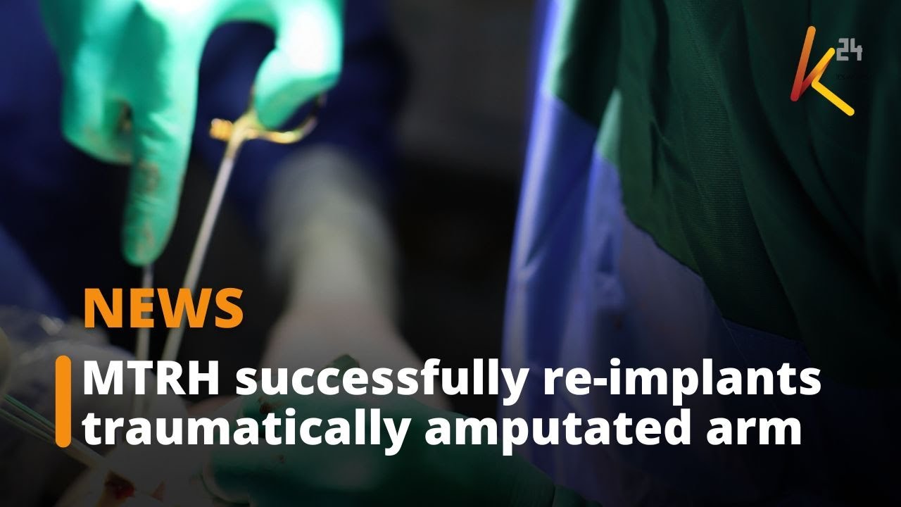 MTRH successfully re implants traumatically amputated arm YouTube