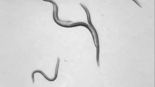 Microscopy of Caenorhabditis elegans