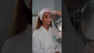 ОТЗЫВ на процедуру ботулинотерапии Миотокс | Коррекция морщин в клинике GEN87 #shorts