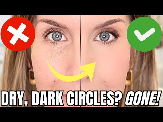 My Full Under Eye Routine for Dry, Mature Skin, Dark Circles & Hollows (No Creasing!)