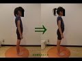 再生回数8.3万回突破!(Over 83000 views) 美容整体変化実績10 子供姿勢矯正実績!posture correction for child before and after