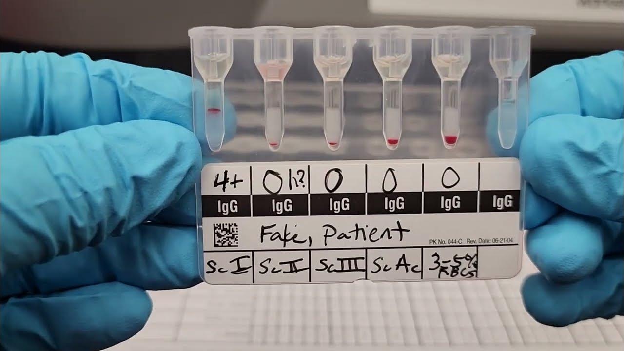 Blood banking gel antibody screen youtube