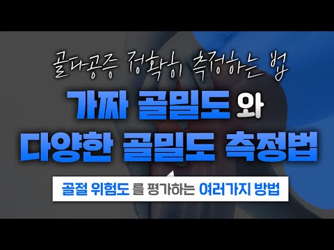 골절 위험도를 예측할 수 있는 쉬운 방법이 있다?