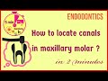 Access opening | Locating canal orifices quickly | Maxillary first molar | easy tips