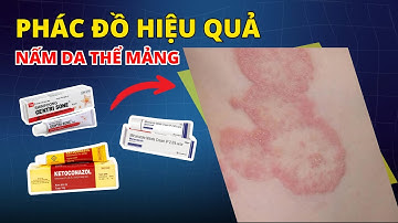 PHÁC ĐỒ ĐIỀU TRỊ NẤM DA THỂ MẢNG – DƯỢC SĨ PHẢI NẮM CHUẨN!  – Eduphar