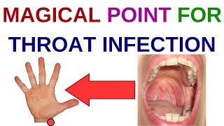 ... very effective acupressure points for sore throat , throat...