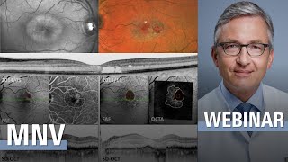 COFFHE with Frank Holz: Neovascularization