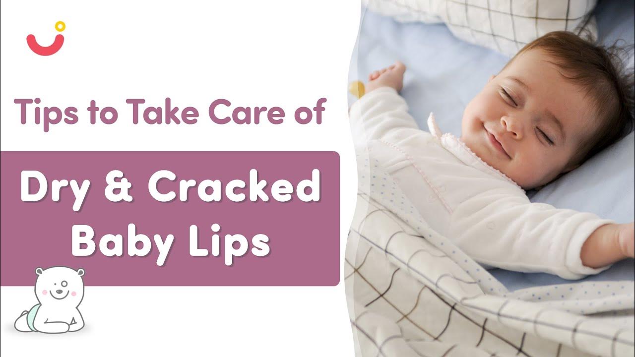How To Treat Chapped Lips In Newborn Babies Tips to Take Care of Dry