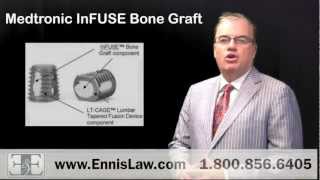 Medtronic Lawsuit Medtronic Infuse Bone Graft Lawsuit