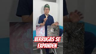 Las verrugas genitales pueden expandirse, por lo que no las debes tocar. #verrugas #vph #docale