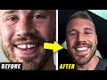 Fixing My Teeth After 31 Years (emotional)