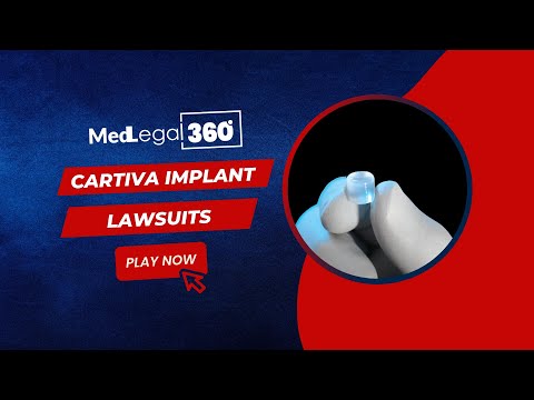 Cartiva Implant Lawsuits
