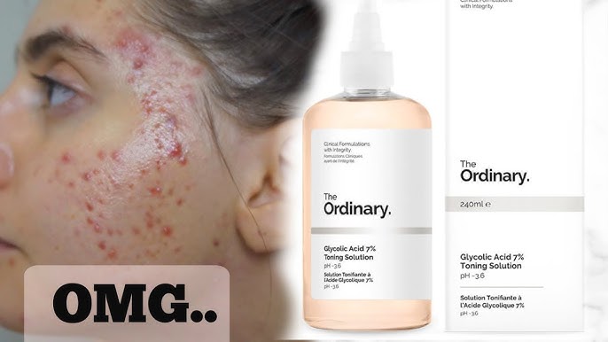 The Ordinary Glycolic Acid 7% Toning Solution - Cassandra Bankson