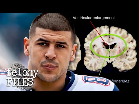 Did Brain Damage Cause Aaron Hernandez To Kill? | Aaron Hernandez Uncovered | Felony Files