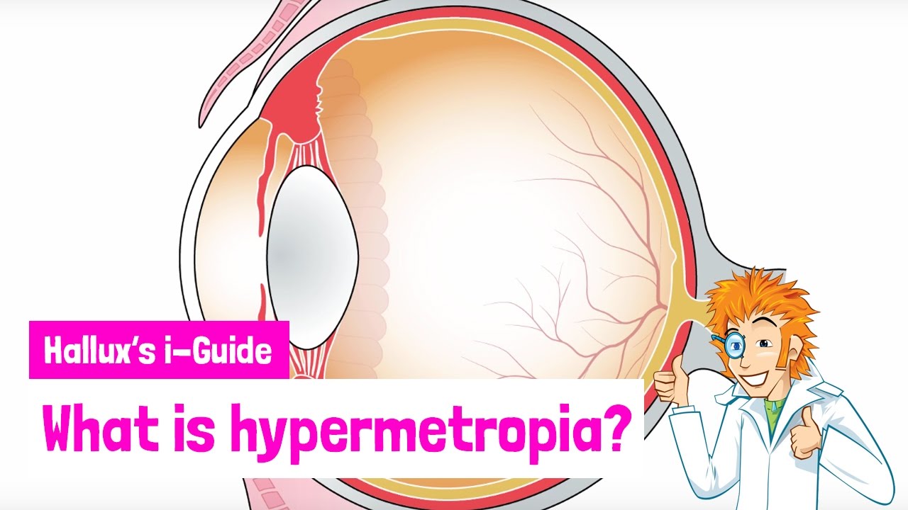 miért jelent meg a hyperopia)