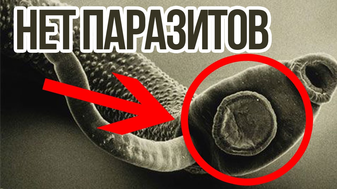 Как быстро вылечиться от остриц самостоятельно - YouTube