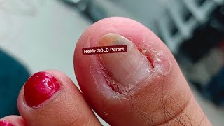 Pedicure Co-worker #satisfying Neldz SOLO Parent  is live!