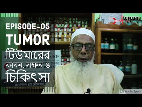 Tumor | টিউমারের কারন, লক্ষন ও চিকিৎসা | Episode 05 | Saima Homeo