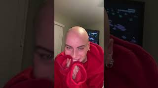 Alopecia is no joke♥️ selflove inspiring empowerment alopecia hairloss baldspots viral