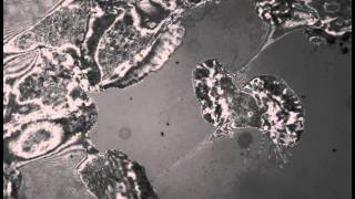 IRM Keratocytes 01 t001c3