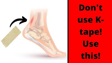 Taping for Achilles Tendonitis - two techniques you won