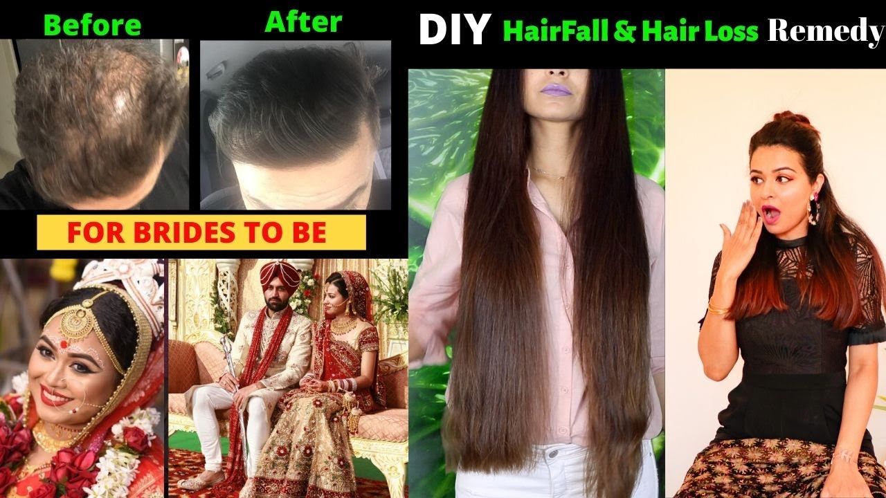 🔥DIY Hairfall & Hair Growth Home Remedy ️ gulz_Beauty YouTube