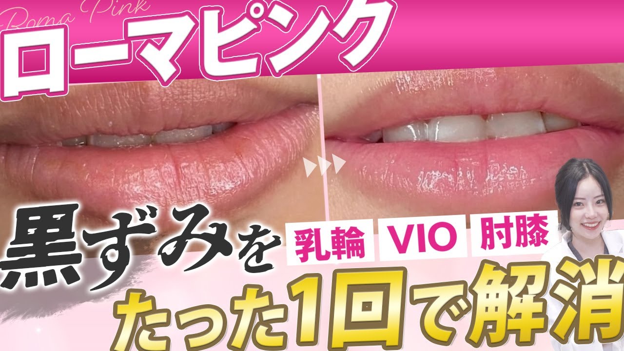 ローマピンク】乳輪 VIO 唇 肘膝の黒ずみを1回で解消！すぐ元に戻る