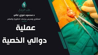 عملية دوالي الخصية/ دكتور محمود فوزي غالي