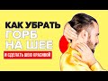 Вдовий горбик, как убрать в домашних условиях? Холка, шишка на шее, как избавиться. Упражнения цигун