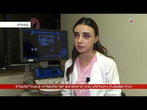 Տղամարդկանց կրծքագեղձի քաղցկեղը ևս ագրեսիվ ընթացք ունի