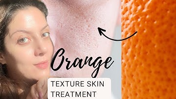Treatment for textured skin I  Oily Skincare I Treatment for large open pores and textured skin