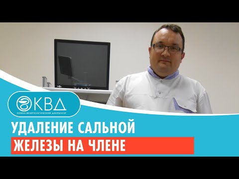 ✅ Удаление сальной железы на члене. Клинический случай №672