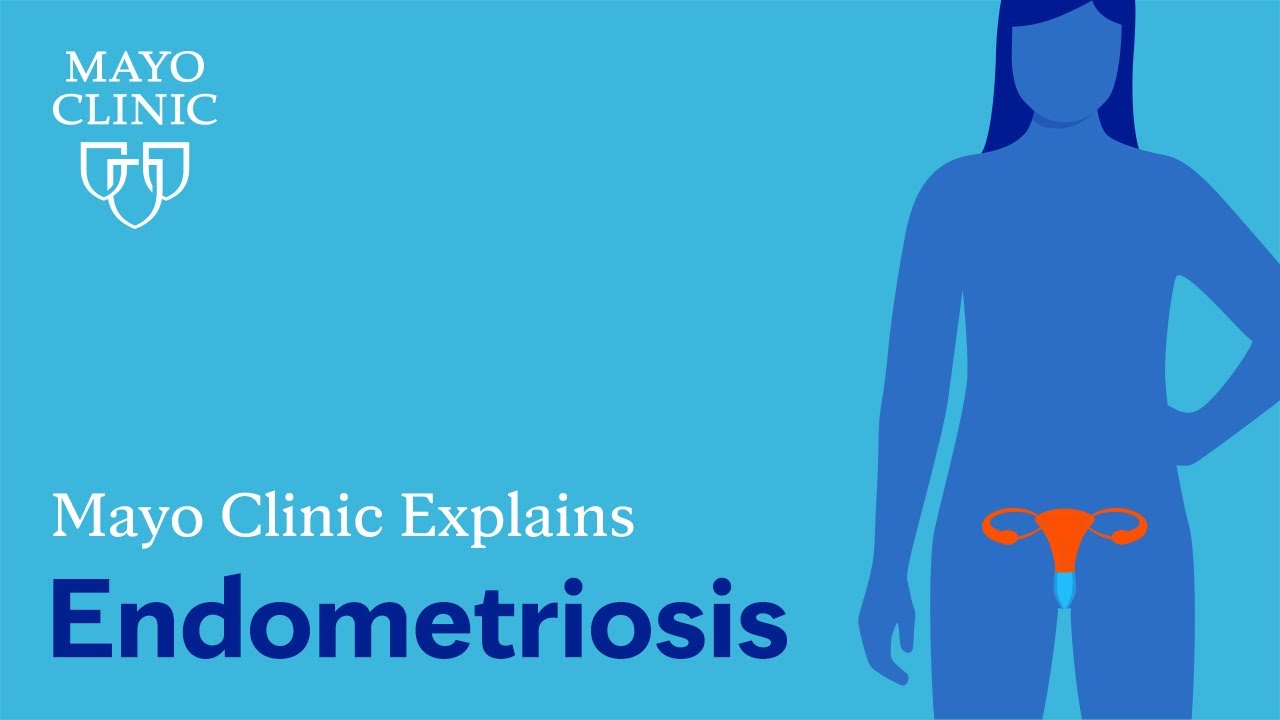 Is Heavy Bleeding During Menstruation A Sign Of Endometriosis? Know From  Expert