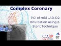 Pci of mid ladd2 bifurcation using 2stent technique  october 16 2018