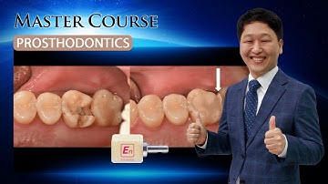 [Master Course - PROSTHODONTICS] Milling workflow for digital_dentistry