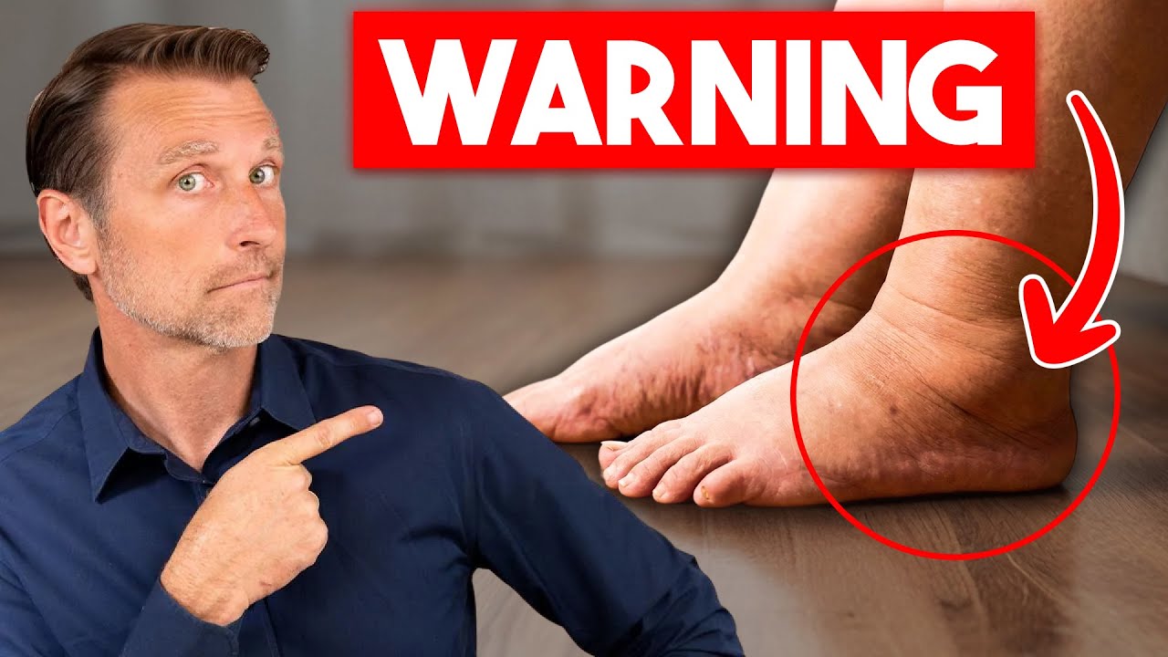 “Why Your Legs Might Be the First to Show Signs of Strain” – Video