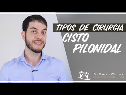 Vídeo: Cirurgia De Cisto Pilonidal: Procedimento, Recuperação E Recorrência