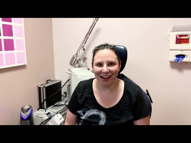 Dallas Botox and Filler Patient Testimonial