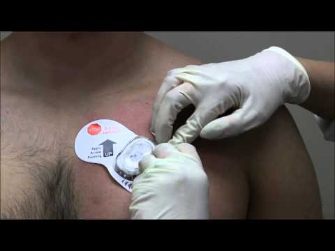 ZIO® XT Patch cardiac rhythm monitor